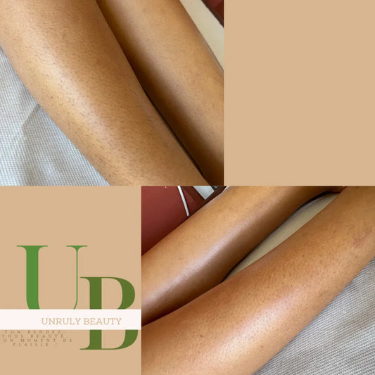 Epilation demi-jambes